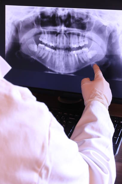 Best Emergency Dentist for Special Needs Patients in Gordon, GA