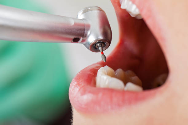 Best Emergency Dental Care for Abscessed Tooth in Gordon, GA